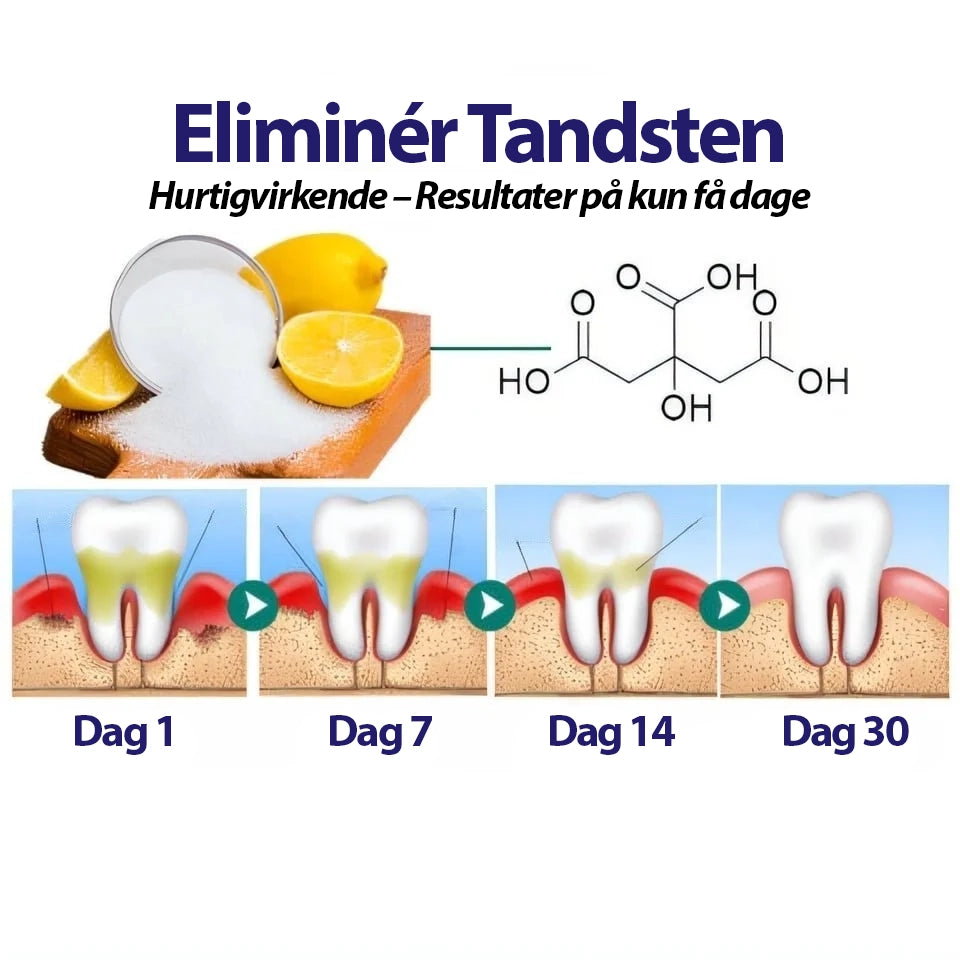 DentiPet